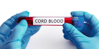 Cord Blood Banking {what expectant moms need to know} Gloved hands holding cord blood in a vial.