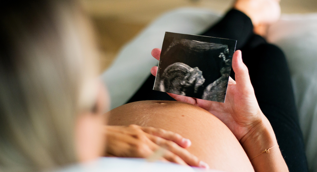 A pregnant woman looking at her sonogram.