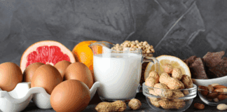 How to Manage Food Allergies at Home Foods that are common allergies.