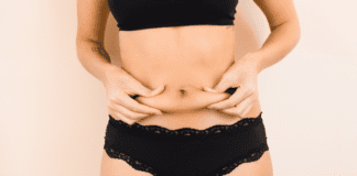 What Exactly is Diastasis Recti? A woman with diastasis recti.